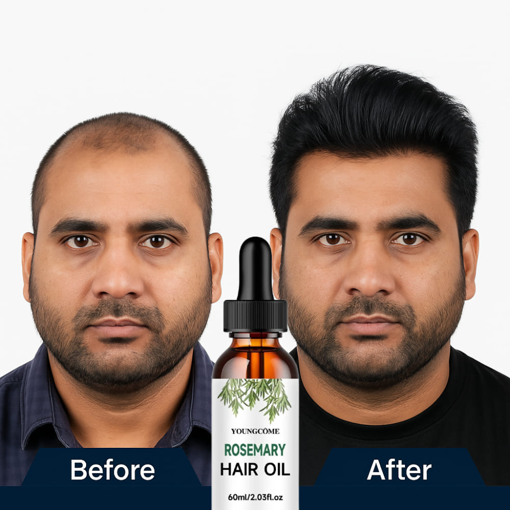 Rosemary Hair Growth & Repair Oil with Mint, Hyaluronic Acid & Vitamin E – Anti-Hair Loss Treatment
